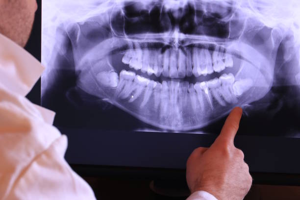Best Emergency Treatment for Oral Infections in Homestead Meadows North, TX
